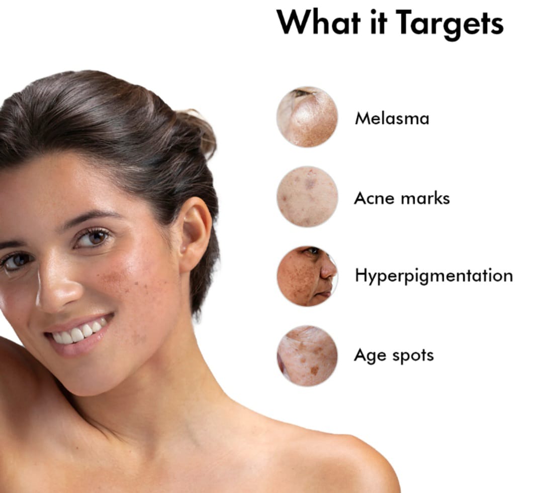 Hyperpigmentation Serum - 30 ml